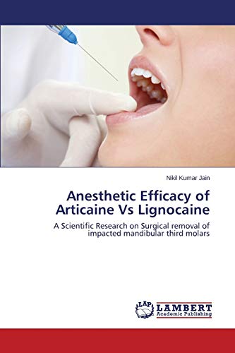 Anesthetic Efficacy Of Articaine Vs Lignocaine A Scientific Research On Surgica [Paperback]