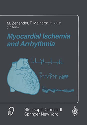 Myocardial Ischemia and Arrhythmia: Under the auspices of the Society of Coopera [Paperback]