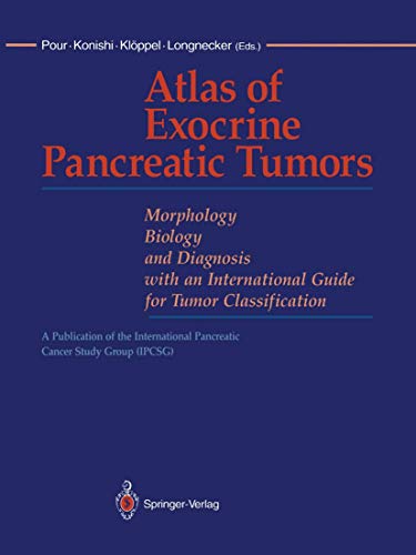 Atlas of Exocrine Pancreatic Tumors: Morphology, Biology, and Diagnosis with an  [Paperback]