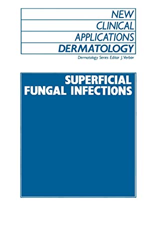 Superficial Fungal Infections [Hardcover]