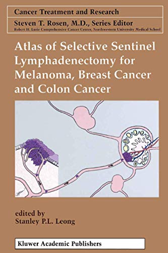 Atlas of Selective Sentinel Lymphadenectomy for Melanoma, Breast Cancer and Colo [Hardcover]