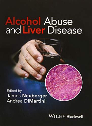 Alcohol Abuse and Liver Disease [Hardcover]