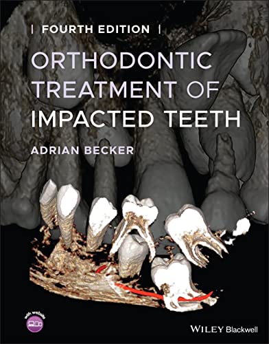 Orthodontic Treatment of Impacted Teeth [Hardcover]