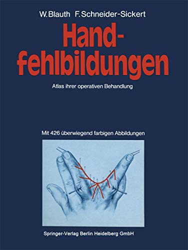 Handfehlbildungen: Atlas ihrer operativen Behandlung [Paperback]