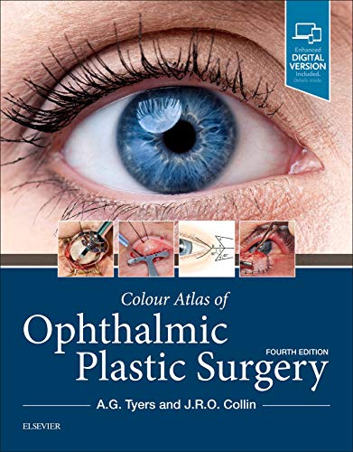 Colour Atlas of Ophthalmic Plastic Surgery [Hardcover]