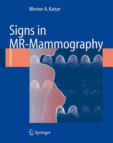 Signs in MR-Mammography [Paperback]