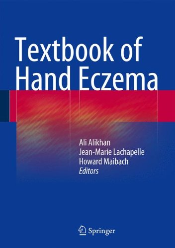 Textbook of Hand Eczema [Hardcover]