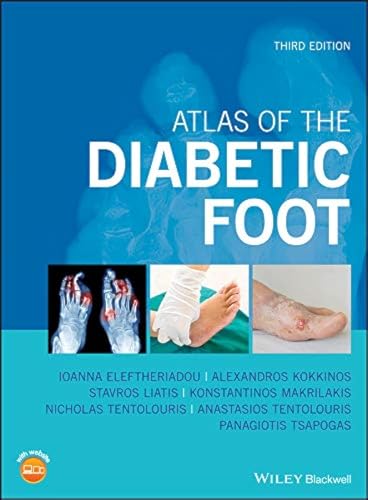 Atlas of the Diabetic Foot [Hardcover]