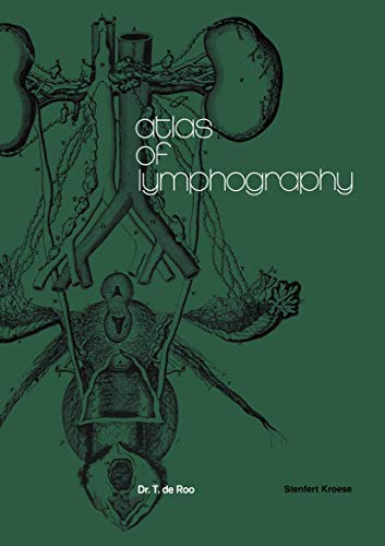 Atlas of Lymphography [Paperback]