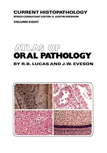 Atlas of Oral Pathology [Paperback]