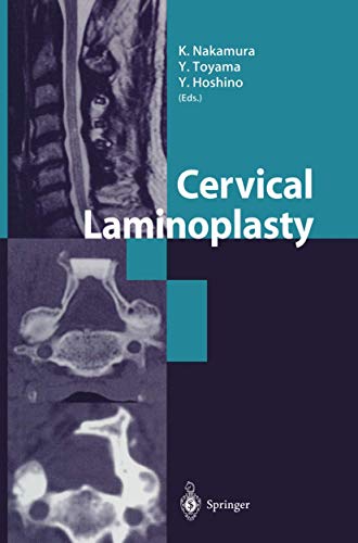 Cervical Laminoplasty [Hardcover]