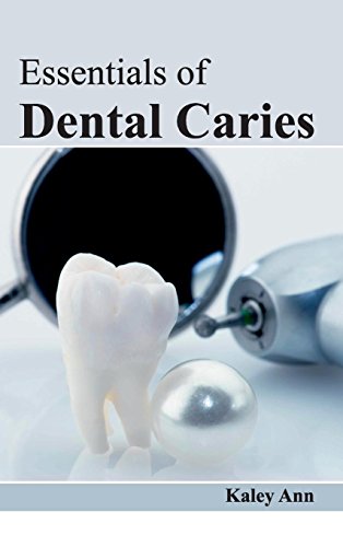 Essentials Of Dental Caries [Hardcover]