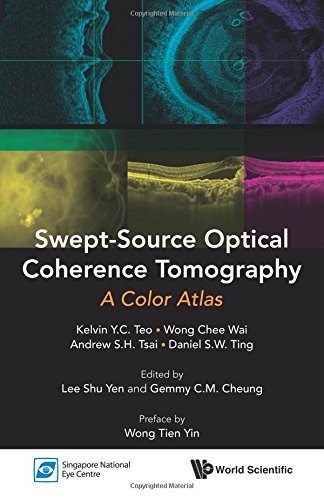 Sept-Source Optical Coherence Tomography A Color Atlas [Paperback]