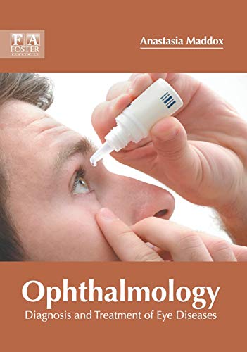 Ophthalmology Diagnosis and Treatment of Eye Diseases [Hardcover]