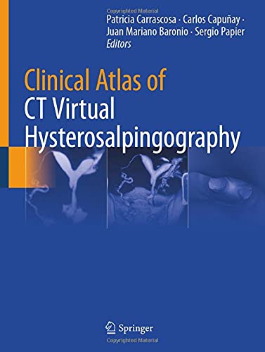 Clinical Atlas of CT Virtual Hysterosalpingography [Hardcover]