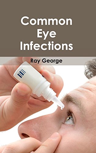 Common Eye Infections [Hardcover]