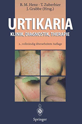 Urtikaria Klinik, Diagnostik, Therapie [Paperback]