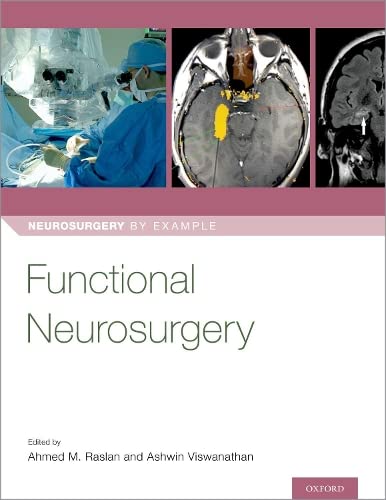 Functional Neurosurgery [Paperback]