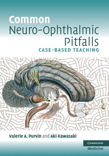 Common Neuro-Ophthalmic Pitfalls Case-Based Teaching [Paperback]