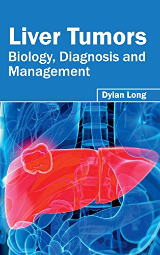 Liver Tumors Biology, Diagnosis And Management [Hardcover]