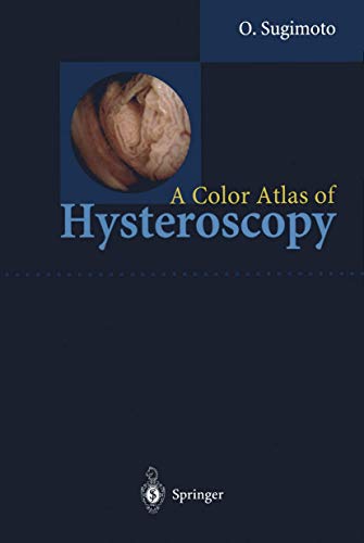 A Color Atlas of Hysteroscopy [Paperback]