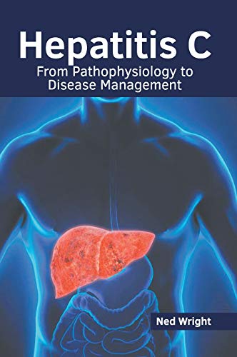 Hepatitis C From Pathophysiology to Disease Management [Hardcover]