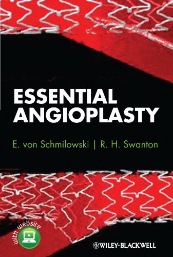 Essential Angioplasty [Hardcover]