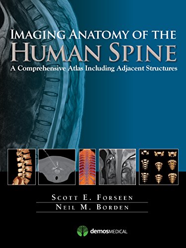 Imaging Anatomy of the Human Spine: A Compreh