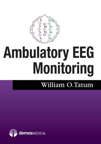 Ambulatory Eeg [Paperback]