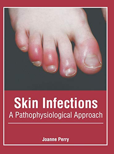 Skin Infections A Pathophysiological Approach [Hardcover]