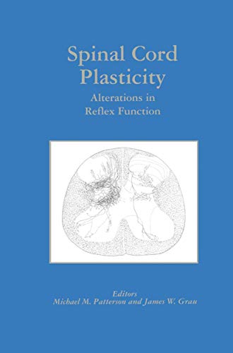 Spinal Cord Plasticity: Alterations in Reflex Function [Hardcover]