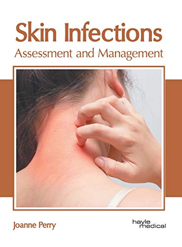 Skin Infections Assessment and Management [Hardcover]