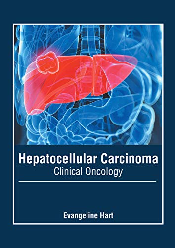 Hepatocellular Carcinoma Clinical Oncology [Hardcover]