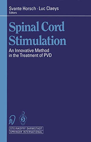 Spinal Cord Stimulation: An Innovative Method in the Treatment of PVD [Paperback]