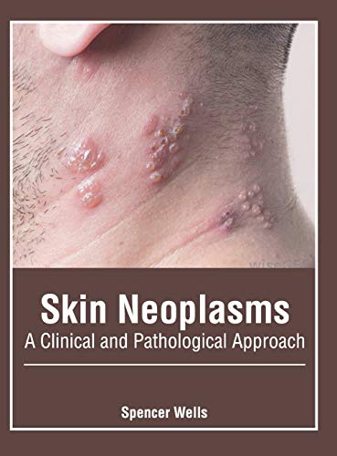 Skin Neoplasms A Clinical and Pathological Approach [Hardcover]