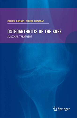 Osteoarthritis of the knee [Paperback]