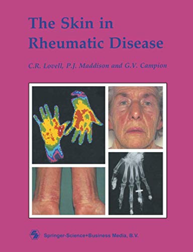 The Skin in Rheumatic Disease [Paperback]