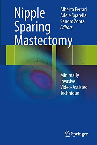 Nipple Sparing Mastectomy: Minimally Invasive Video-Assisted Technique [Hardcover]