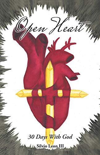 Open Heart [Paperback]