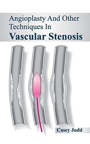 Angioplasty And Other Techniques In Vascular Stenosis [Hardcover]