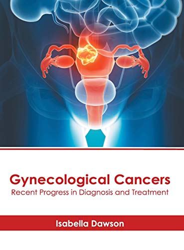 Gynecological Cancers Recent Progress in Diagnosis and Treatment [Hardcover]