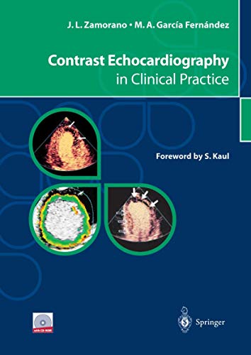 Contrast Echocardiography in Clinical Practice [Paperback]