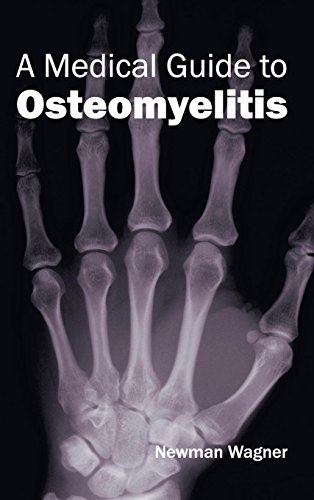 A Medical Guide To Osteomyelitis [Hardcover]