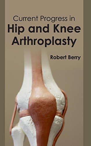 Current Progress In Hip And Knee Arthroplasty [Hardcover]