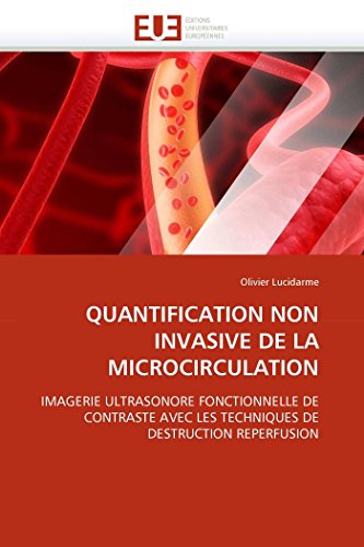 Quantification Non Invasive de la Microcirculation [Paperback]